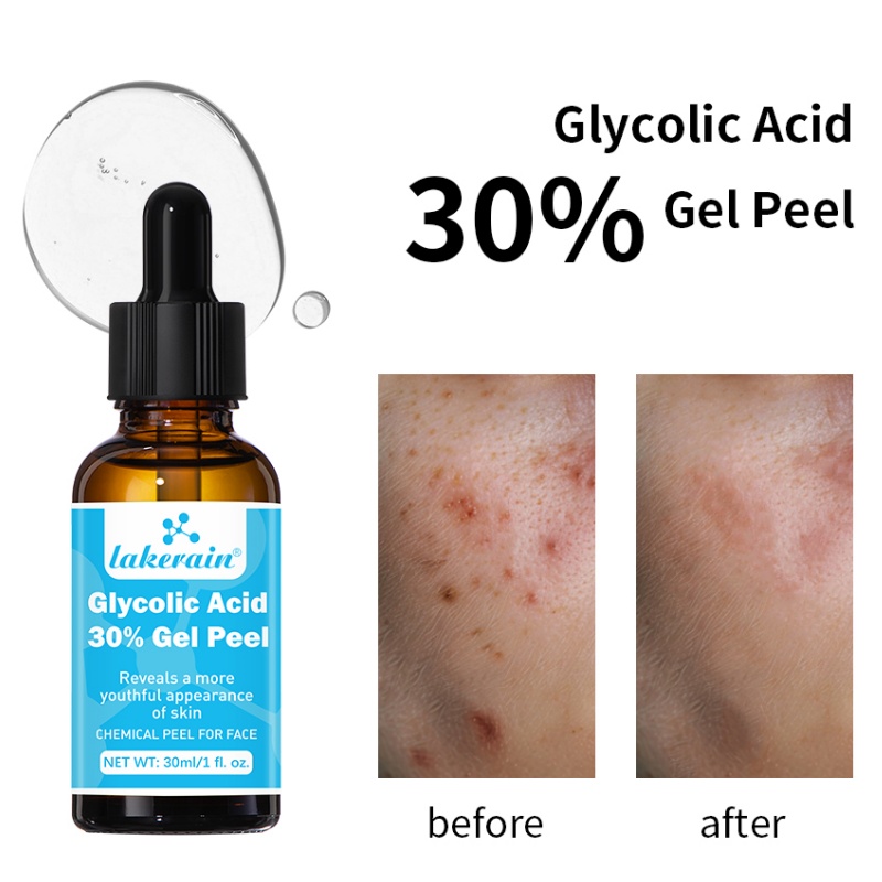 Gel exfoliante de ácido glicól - Lactic Acid Toner reseña y precio